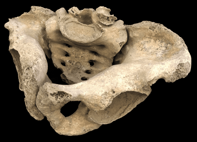 Studi / Così nella Milano dell’alto Medioevo fragilità ossea, e forse celiachia, contribuirono alla morte di due donne incinte (e dei loro bimbi mai nati)